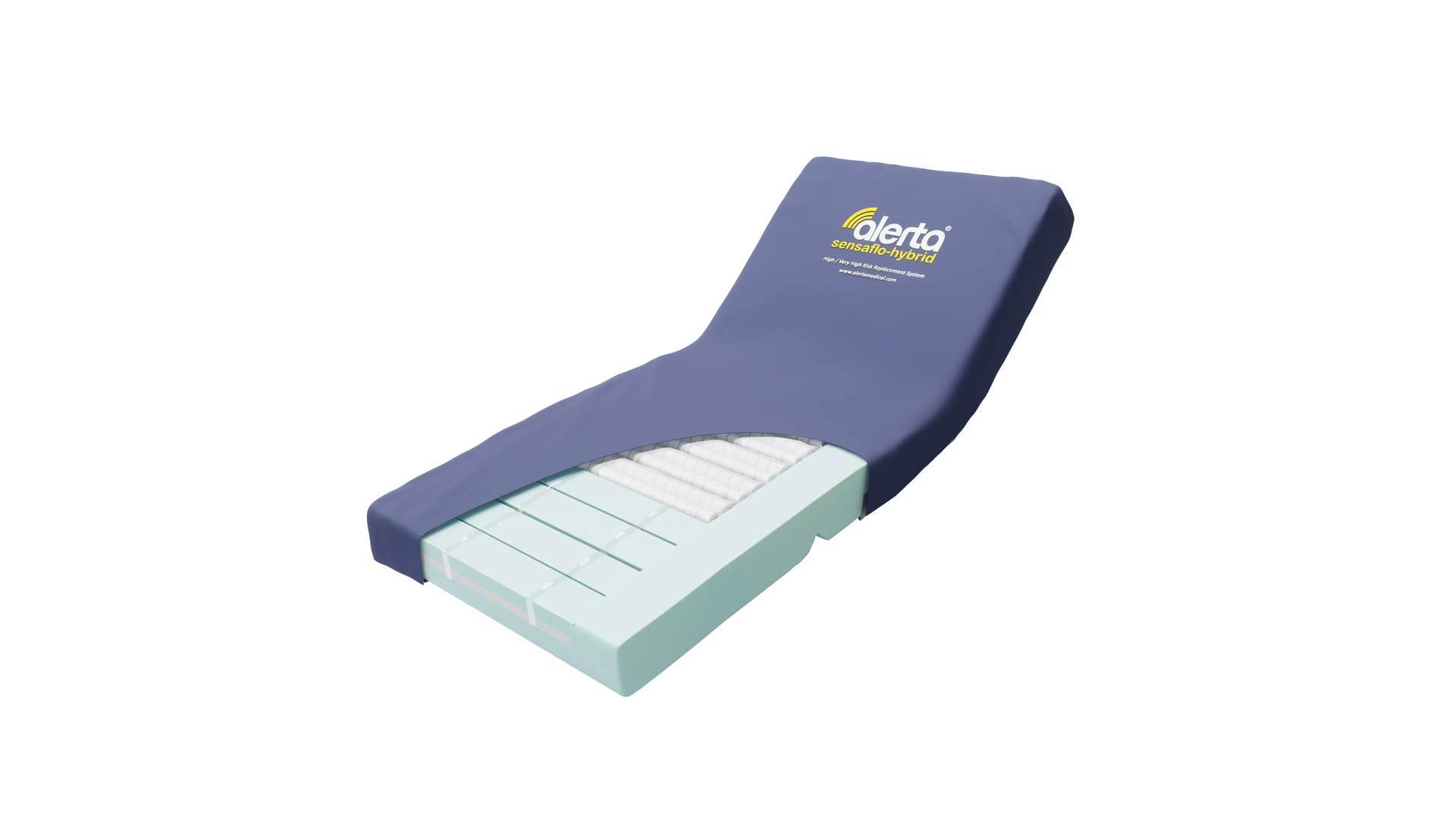 Alerta Sensaflo Hybrid Replacement System 2